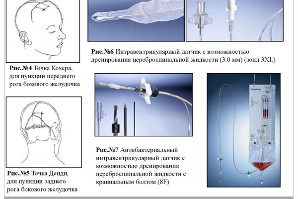 Кракен 18ат